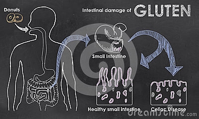 Jelitowa szkoda gluten - Obraz Royalty Free z Dreamstime.com